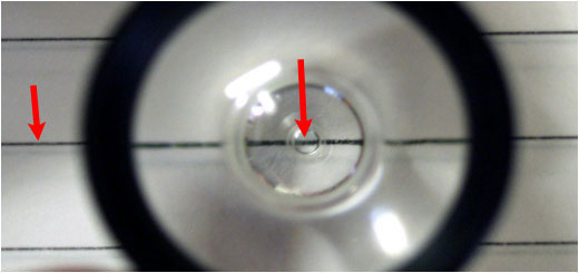 Volk Blumenthal Suturelysis Lens- line seen magnified through the lens