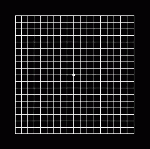 Amsler Grid - Glaucoma & Cataract, Prof. Eytan Blumenthal